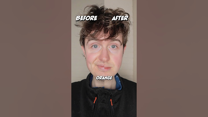 Kan äta morötter göra dig orange?