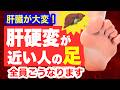 肝硬変が近い人だけに起こる「足の異変」と予防法