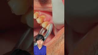 歯が抜ける瞬間