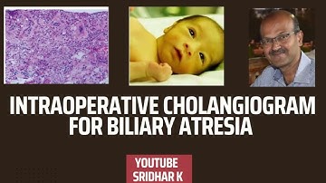 Intraoperative cholangiogram and peroperative biopsy to diagnose biliary atresia #biliaryatresia