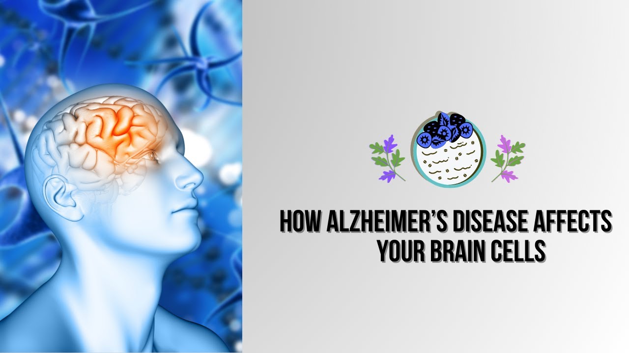 How Alzheimer's Disease Affects Your Brain Cell Alzheimer's Affect