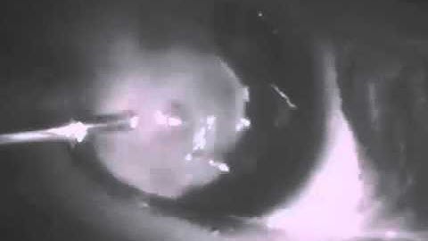 High-speed aluminum pulse welding