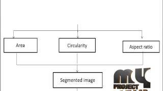Final Year Projects 2015 | An Efficient Automated System for Detection of Diabetic Retinopathy
