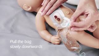 CPOC SMio Baby Parents HTU 2 piece – flex coupling drainable bag