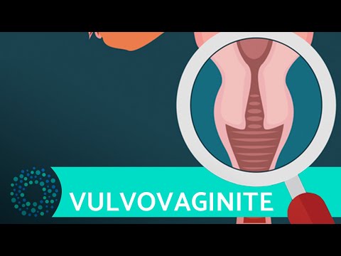 Vídeo: Por que a vulvovaginite coça?