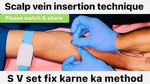 Scalp vein insertion technique | How to fix SV Set procedure #views #hospital #nurse #viralvideo