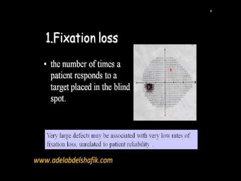 Visual Field Chart Interpretation