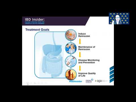 IBD A to