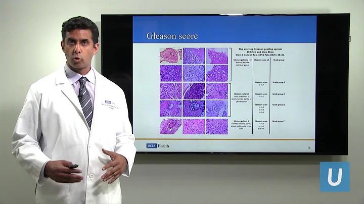 Making Decisions After Being Diagnosed with Early Stage Prostate Cancer | UCLAMDChat - DayDayNews