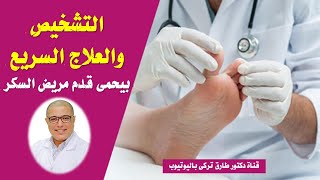 ?? تعرف ان التشخيص والعلاج السريع بيحمى قدم_مريض_السكر ??