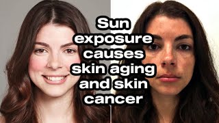 Sun exposure, skin aging, skin cancer, and seed oils