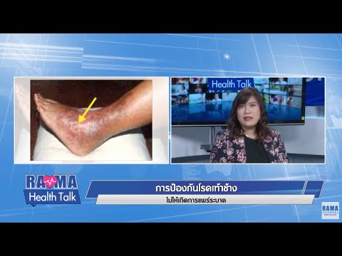 พบหมอรามาฯ : การป้องกันโรคเท้าช้างไม่ให้เกิดการแพร่ระบาด : Rama Health Talk (ช่วงที่ 1) 25.10.2562