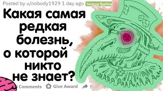 КАКАЯ САМАЯ РЕДКАЯ БОЛЕЗНЬ, О КОТОРОЙ НИКТО НЕ ЗНАЕТ?