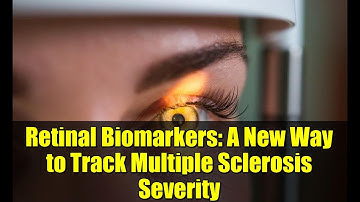 Retinal Biomarkers: A New Way to Track Multiple Sclerosis Severity