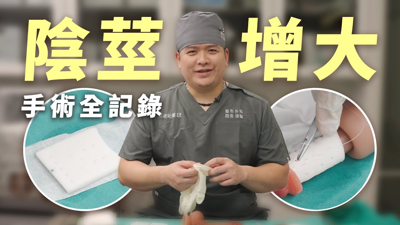 【增大實境秀】1比1真人比例，最真實的陰莖增大術手術全記錄｜徐詣整形外科醫師