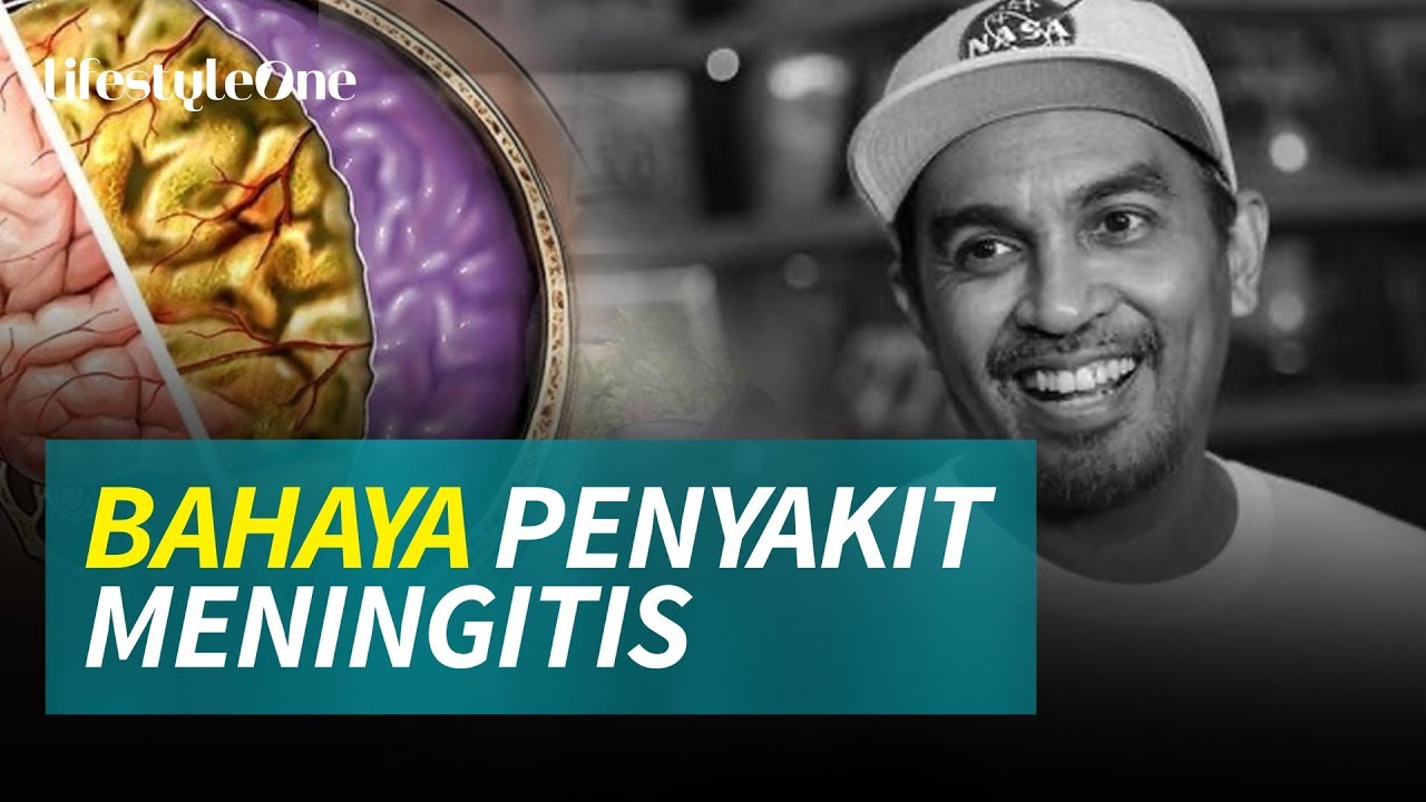Kenali Bahaya Meningitis! Penyebab Glenn Fredly Meninggal Dunia | Kata Dokter