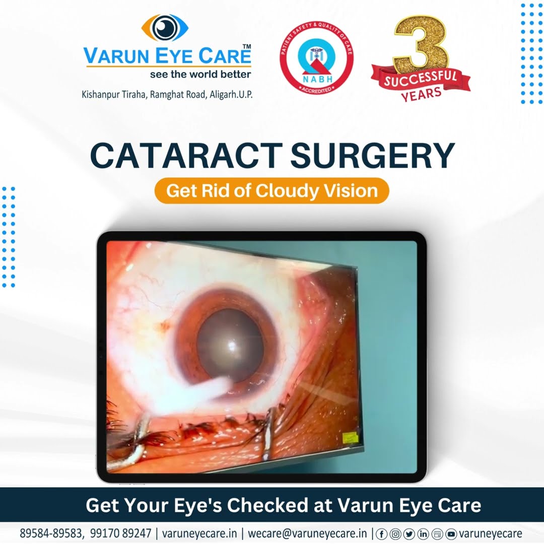 Cataract Surgery Get Rid Of Cloudy Vision YouTube Cataract Surgery Get Rid Of Cloudy Vision YouTube