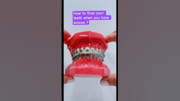 How to floss your teeth when you have braces? #shorts #dentist #braces