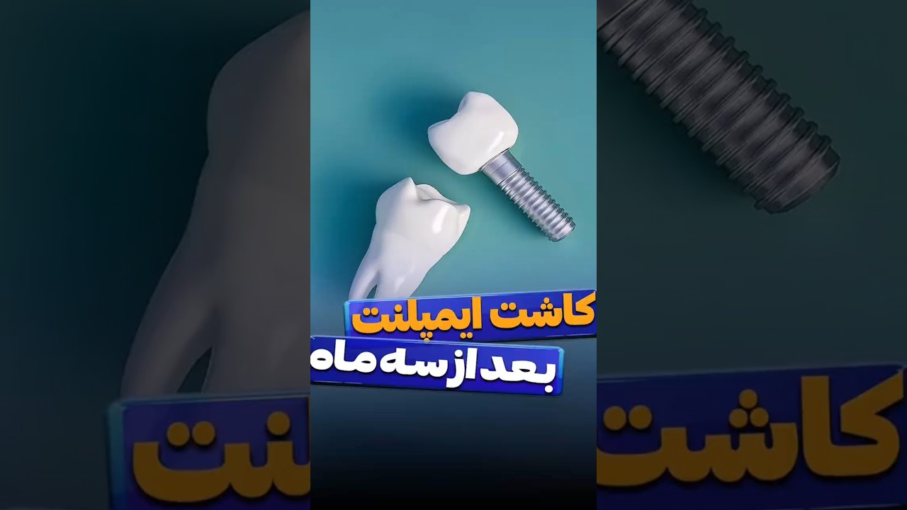 کاور ویدیوی یوتیوب