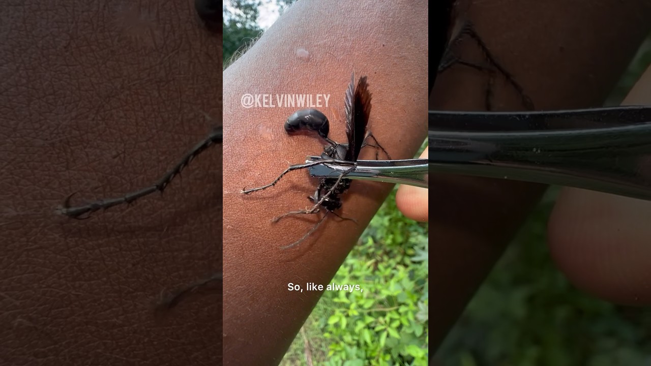 Укус чёрной осы!!!