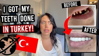 I GOT MY TEETH DONE IN TURKEY!