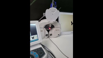 Unicos UDR-800 Sell by U and I optic instrument