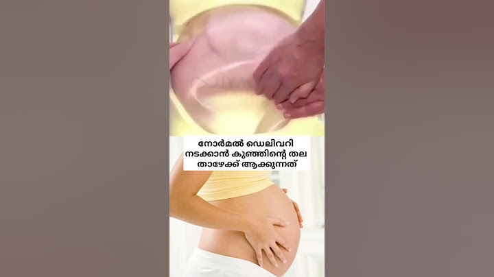 നോർമൽ ഡെലിവറി നടക്കാൻ കുഞ്ഞിന്റെ തല താഴേക്ക് തിരിക്കുന്നത്🥺💯 #pregnancy #malayalam #trending #shorts