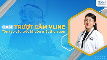 CASE TRƯỢT CẰM VLINE - TÔN TẠO CẤU TRÚC KHUÔN MẶT THON GỌN