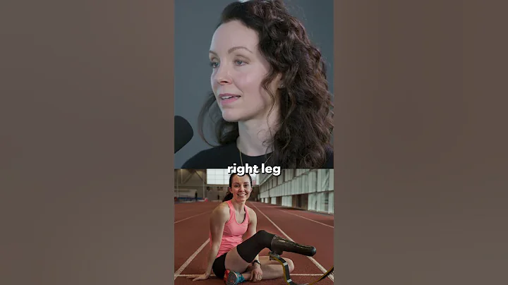 Losing your leg in a boat accident 💔