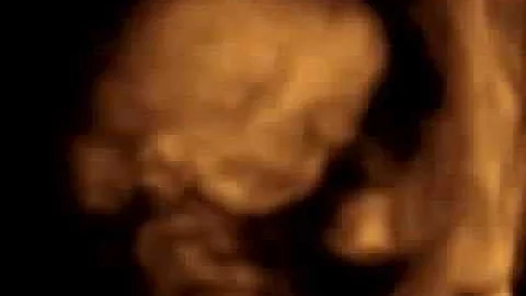 4D Dulcie baby scan