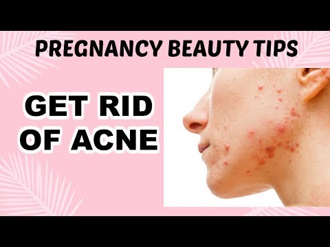 GET RID OF ACNE | PREGNANCY BEAUTY TIPS