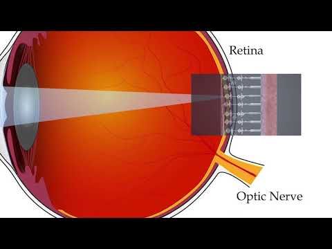 How does an artificial retina work?