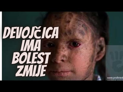 Video: Gljivične Bolesti Gmazova I Zmija