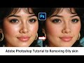 Remove Oily Skin In Adobe Photoshop #photoshop #oilyskin #photoshoptutorial #portraitretouching