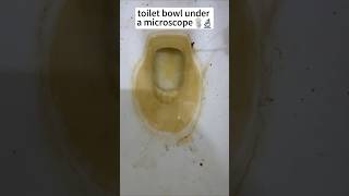 unexpected view toilet bowl under the microscope 😱🔬 #shorts #facts #microscope #toilet #funny