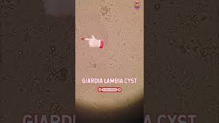 Giardia Lambia Parasite Cyst In Stool Microscopy