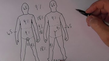 Burns 13, regel van negen