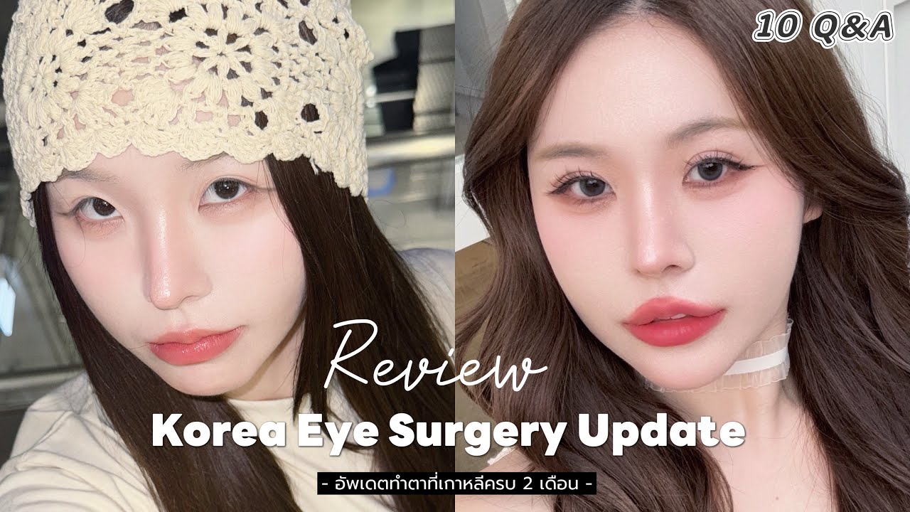 ⋆˚୨୧ ̊ ̟ รีวิวทำตาที่เกาหลี (แบบละเอียดยิบ!) อัพเดตปัจจุบัน 2 เดือน ⋆˚ mukkywana