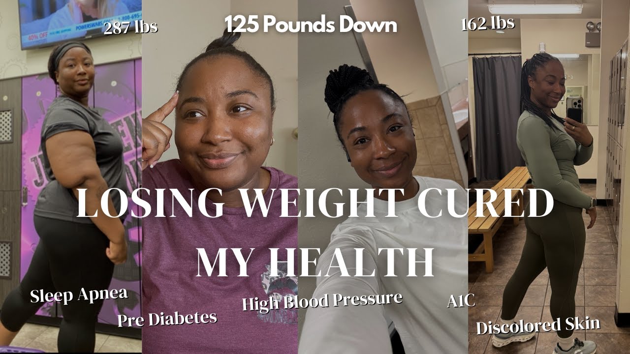 How Losing 125 Pounds *Cured* ALL of my Health Issues | BYE-BYE Pre Diabetes, Sleep Apnea, & MORE