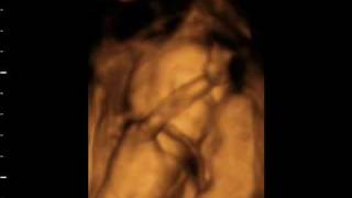 18_weeks.wmv screenshot 5