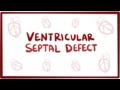 Ventricular septal defect (VSD) - repair, causes, symptoms & pathology