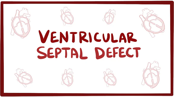 Ventricular septal defect (VSD) - repair, causes, symptoms & pathology - DayDayNews