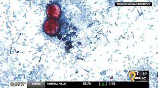 Cyclosporiasis: what to know about the parasite found in produce