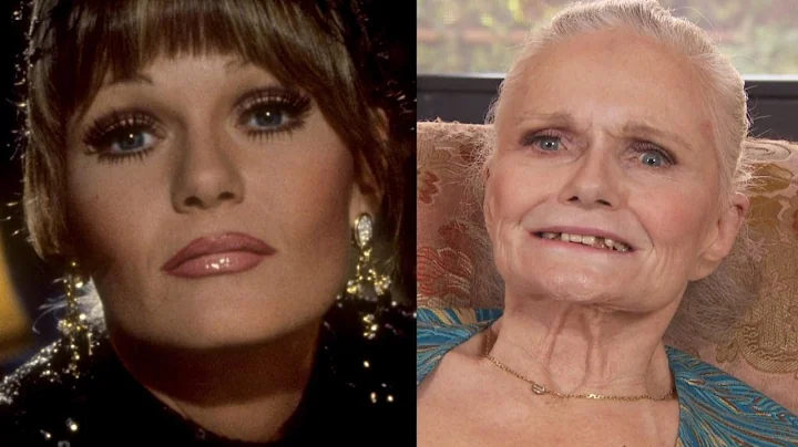 Superman Star Valerie Perrine Gets New Teeth After...