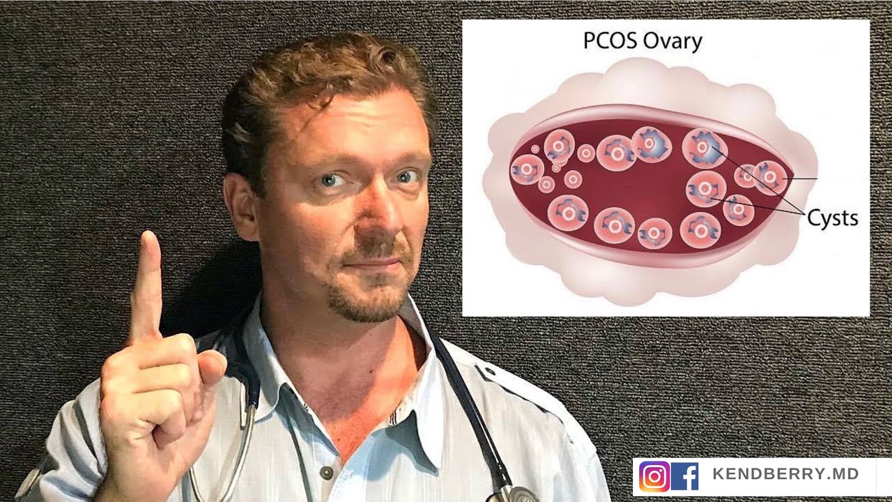 PCOS: Could it be Your DIET? (Fertility Update 2019)