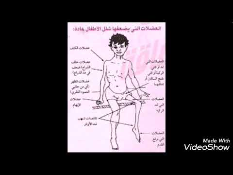 شلل الأطفال الدكتورة ورود العواملة