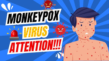 Monkeypox Virus ALERT What You Need to Know NOW