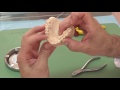 Realización Arco vestibular ortodoncia removible
