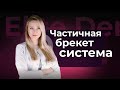 Частичная брекет-система