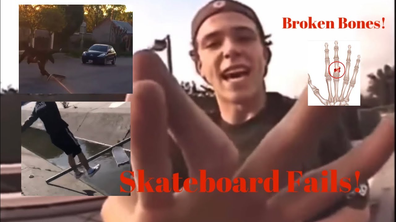Major Pain Skateboard Accidents (Knockouts & Regret) *Ouuu!* Repost